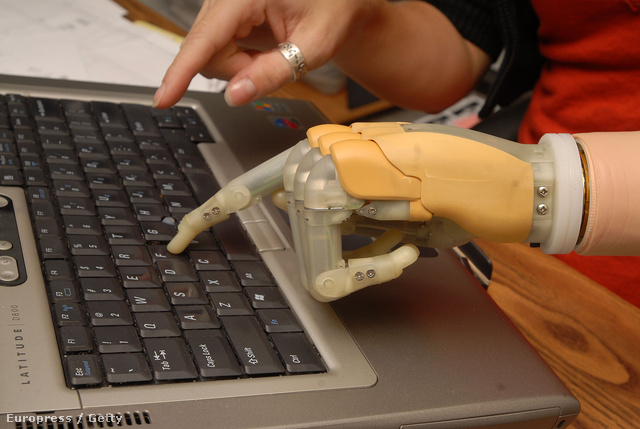 Az első kereskedelmi forgalomban kapható bionikus kéz, melynek ujjai is külön mozgathatók (Fotó: Brandi Simons)  