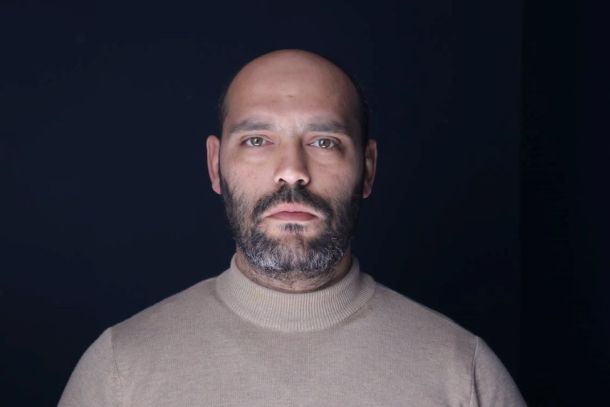 aesthetica.hu öregedés bőr arc